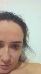 Tumorvosa webcam model stream image