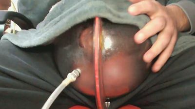 Melon_4_u webcam model stream image